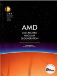 AMD Age-related Macular Degeneration (veľký formát) - náhled