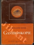 Gastroskopie - náhled