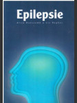 Epilepsie - náhled