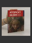 Atopický ekzém - náhled