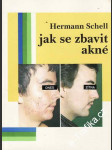 Jak se zbavit akné - náhled