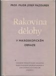 Rakovina dělohy v mikroskopickém obraze (veľký formát) - náhled