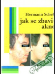 Jak se zbavit akné - náhled