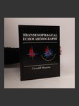 Transeosophageal echocardiography - náhled