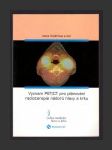 Význam PET/CT pro plánování radioterapie nádorů hlavy a krku - náhled